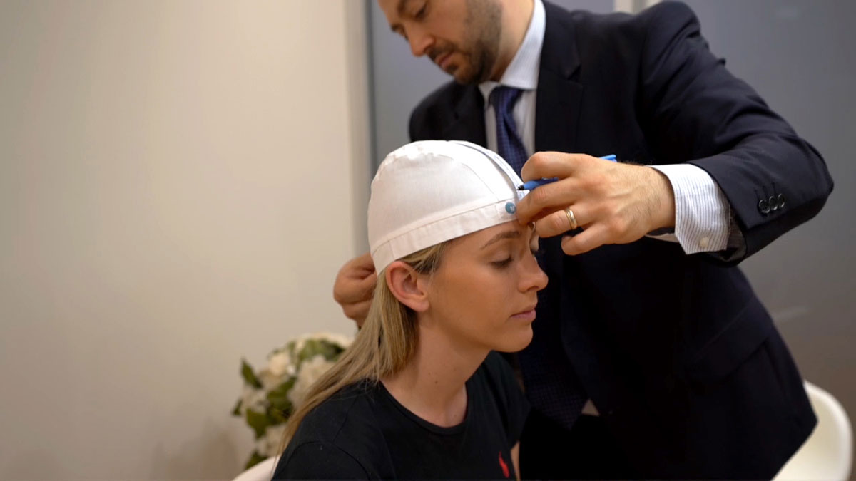 transcranial magnetic stimulation demo at sydney tms clinic tms